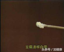 改善白带异常饮食有良方,从中医角度看白带异常