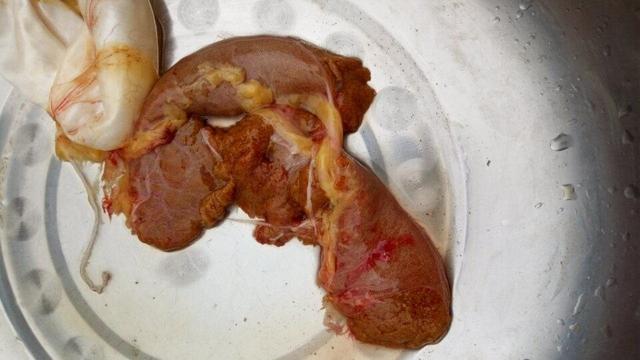 鲤鱼和草鱼怎样区分,鲤鱼还是草鱼好