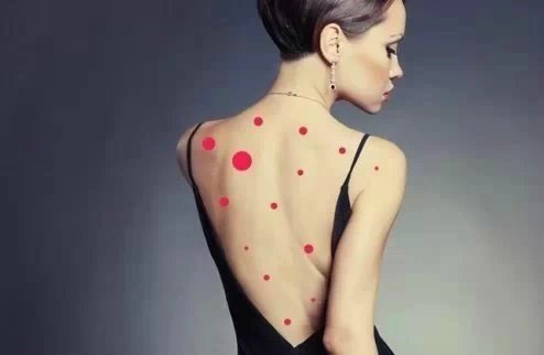 十五岁女孩后背长痘是什么原因,女性后背长痘还痒是什么原因