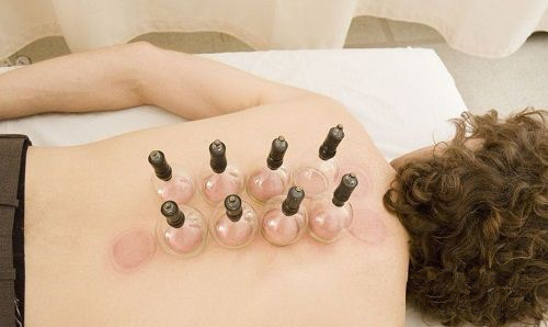 根据拔罐后皮肤的颜色鉴定你的身体到底是怎么了