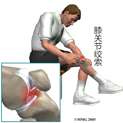 长期运动如何保护膝盖,修复膝盖关节最好的运动