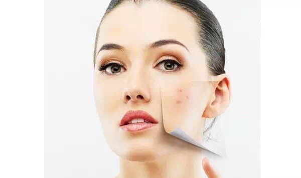 痘痘里面挤出来的白色东西是什么,挤了痘痘好了就长出肉疙瘩啥原因