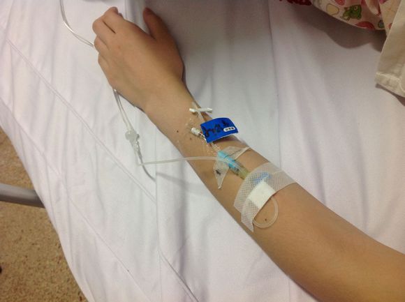 留置针方便反复穿刺的危害,留置针可以避免来回扎针吗