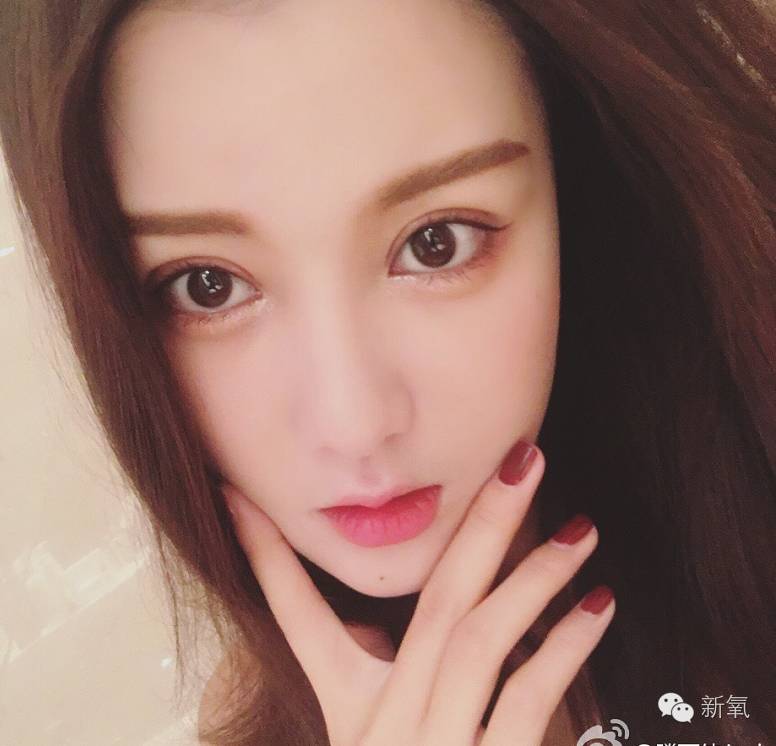 双眼皮变脸真实案例,网红双眼皮最成功的