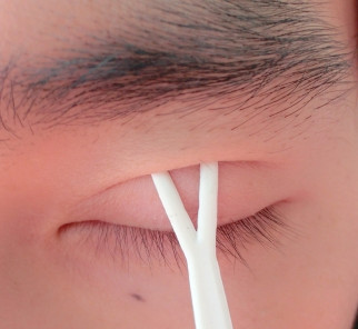 双眼皮最快做法,如何快速的自然形成双眼皮