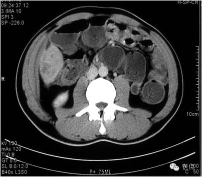 鐥呯悊鍒囩墖闃呯墖澶ц禌,鐥呯悊闃呯墖姣旇禌
