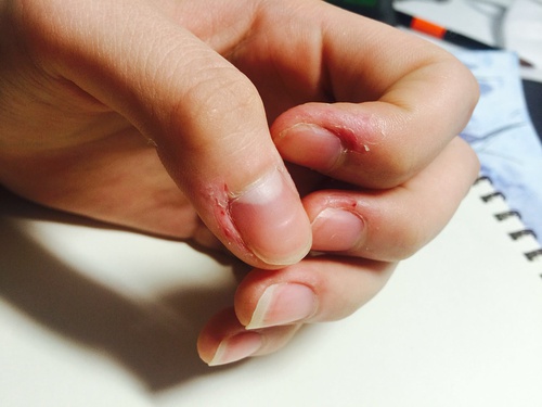 就算剁了手也改不了的小毛病!为什么就不能好好享受呢?