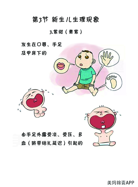 皮肤青紫是什么病,宝宝发烧皮肤青紫怎么回事