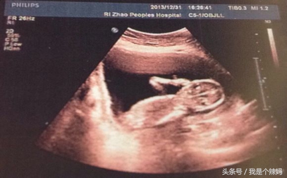 关于胎儿性别的鉴定，到底哪种准确率高一些，哪种失误率更大？