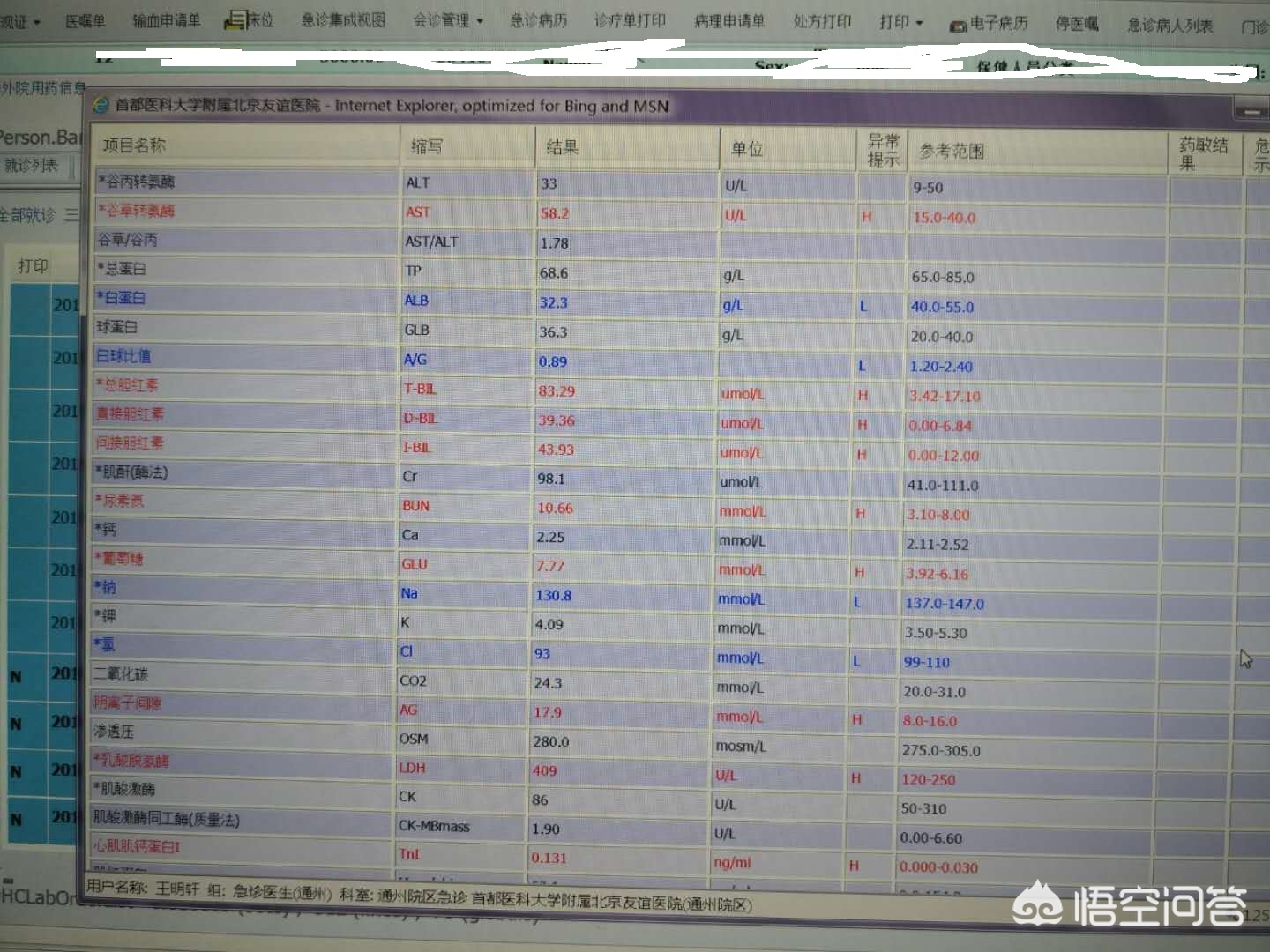 黄疸的分类及鉴别诊断要点,黄疸分类及特点