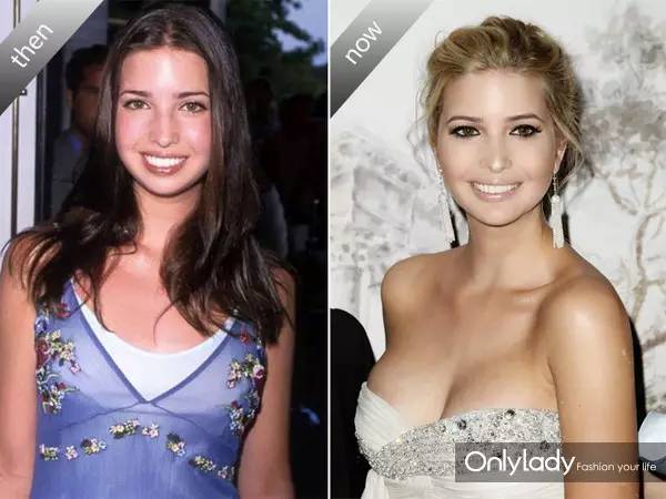 希拉里牙齿怎么样,希拉里的女儿怎么样