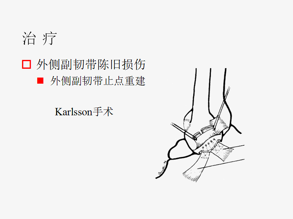 脚崴了怎么办判断是否骨折,脚崴了怎么办视频