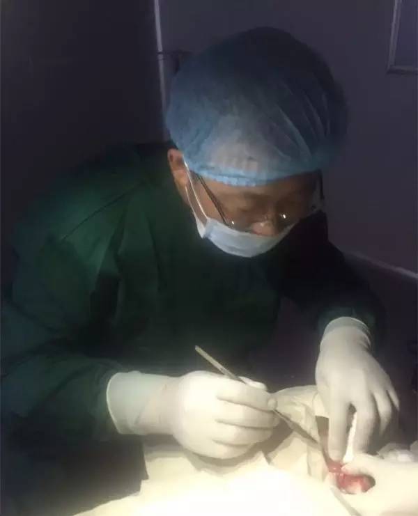 手电筒手术,医生使用无影灯做手术的图片
