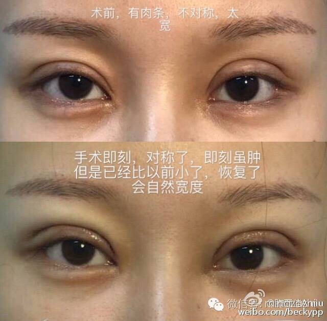 婊曢洦浣虫灄鐝婄強瀵规瘮,婊曢洦浣虫灄鐝婄強瑙嗛