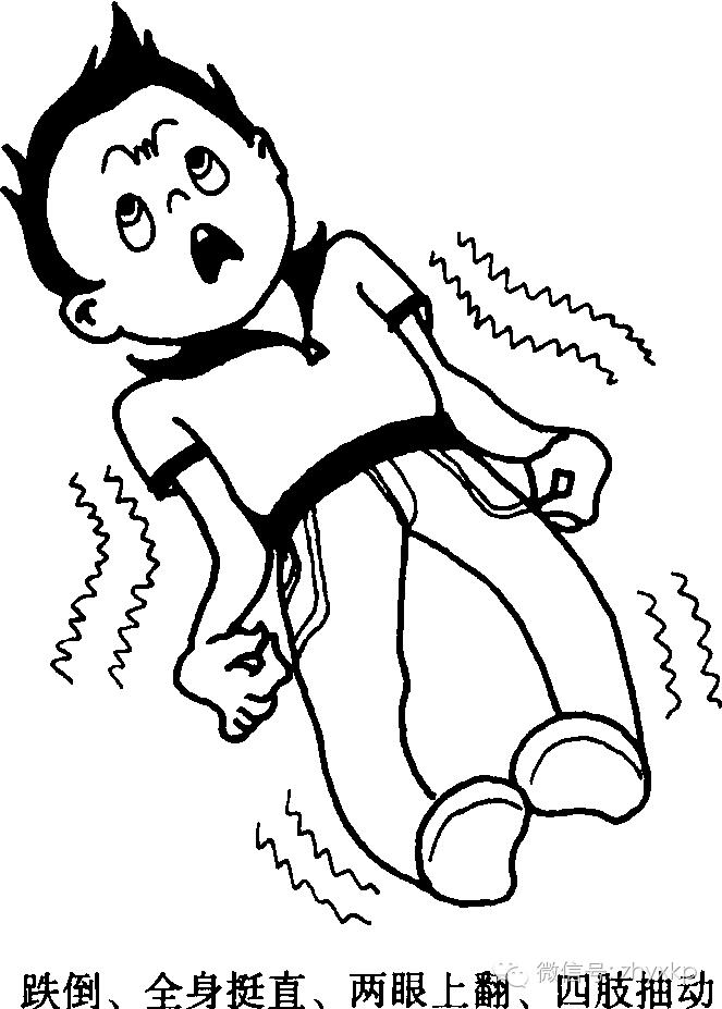 惊厥癫痫怎么才能控制发作,癫痫病发作时的惊厥怎么办