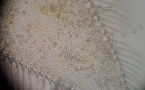 对虾纤毛虫哪个阶段比较容易出现,怎样防治对虾的孢子虫