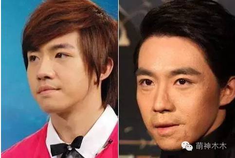 俞灏明烧伤后恢复了吗,被烧伤前的俞灏明照片