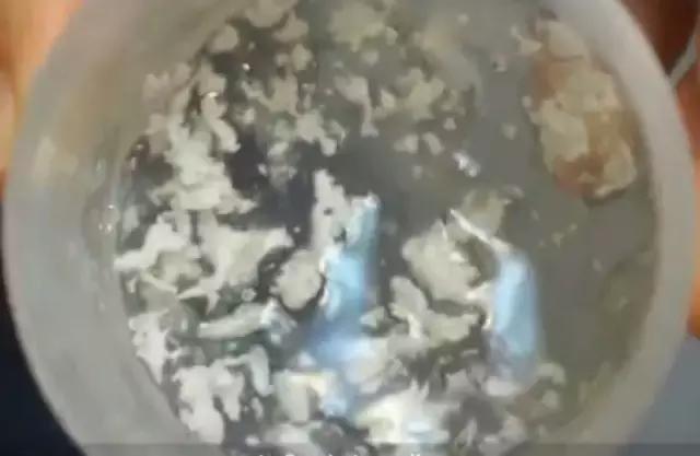 怎么样才能年轻10岁在家自制面膜,1分钟自制天然面膜