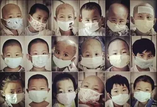 从罗一笑事件来看，白血病为何能导致头发*光脱**