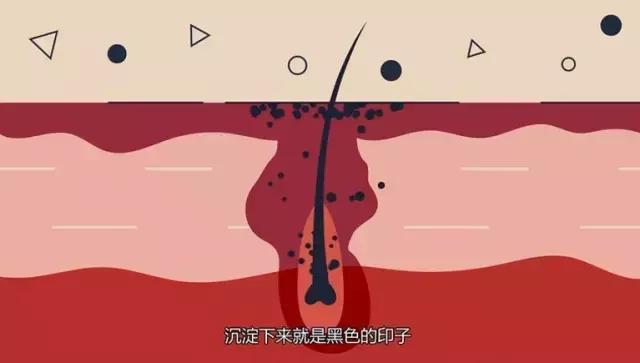 痘痘黑头粉刺怎么治最有效,协和医生图说治痘痘最好的方法