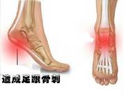 20厘米高跟鞋训练方法,高跟鞋矫正训练方法有哪些