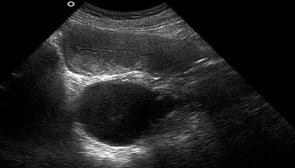 孕妈们注意，产前的这7个检查一个都不能少！