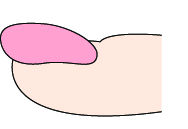 指甲出现白点、纵纹是怎么回事?