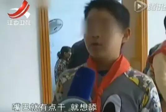 冬天嘴唇干裂破皮?这些护唇方法你一定用得上!