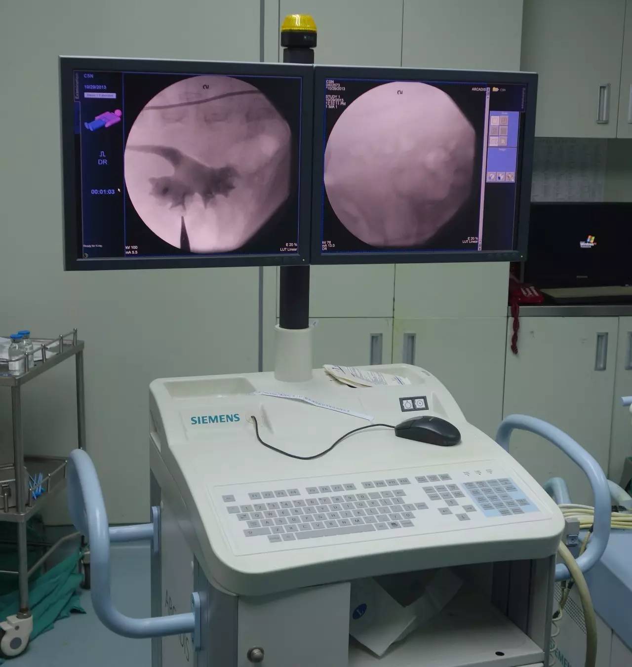 微创肾镜下肾结石碎石取石术,经皮肾镜肾结石激光碎石全过程