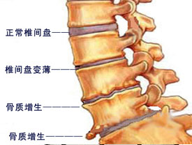 腰疼是有重大疾病吗,腰疼除了腰的问题还有别的原因