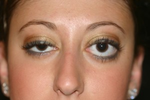 九死也难一生的甲亢“纹身”青年，与一筐“红鸡蛋”