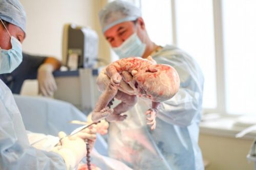 分娩时遇到男医生是怎样一种体会,分娩遇到男医生是种怎样的体验