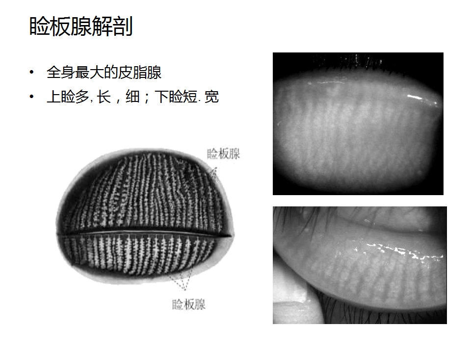 眼睑缘炎的发病原因,眼睑炎的症状和治疗方法