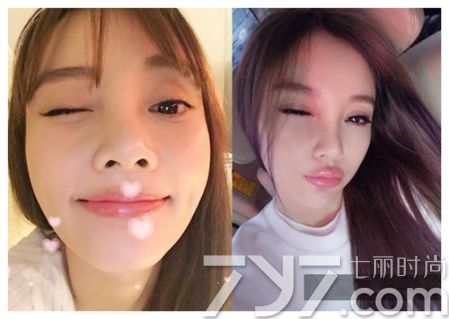 扒一扒韩国明星整容,整容保质期