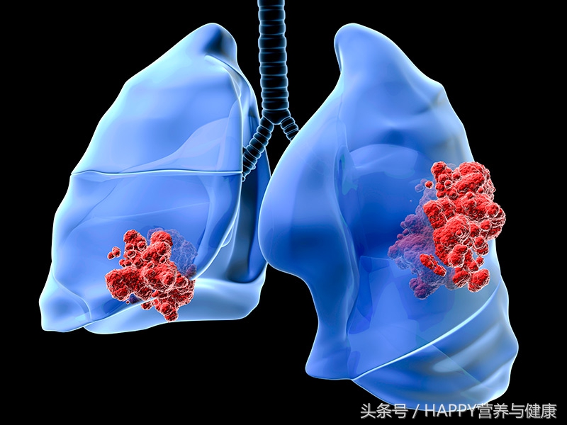 口臭不是牙齿的问题去医院查什么,口臭不是肠胃问题还能是什么