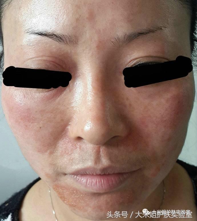 无添加fancl产品,无添加fancl水乳油皮套装