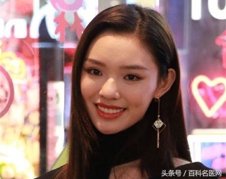 整牙真的可以变脸!想做烤瓷牙的看过来:烤瓷牙种类及各自优缺点