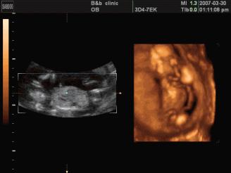 镇原协和医院四维彩超怎么样,镇原做四维多少钱