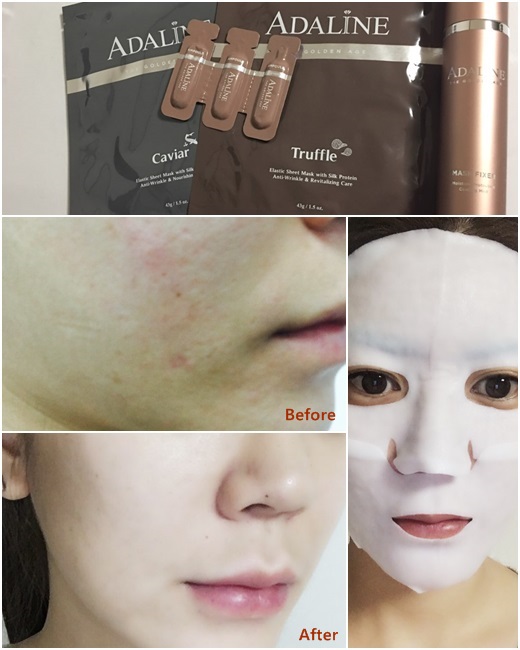 深评ADALINE皑得琳黄金岁月系列三步面膜受赞