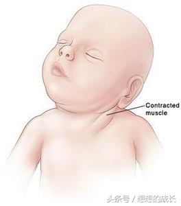 新生儿满月头必须得剃吗,宝宝剃满月头需要注意什么