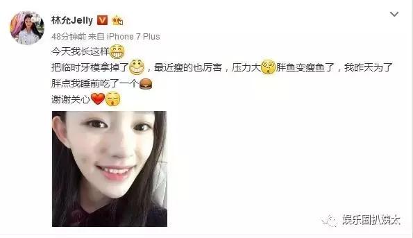 林允因换牙变脸?徐娇从假小子变小女人?星女郎现在都怎么样了?