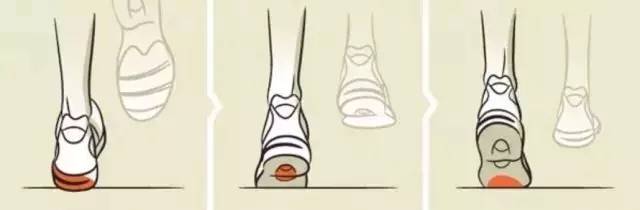选鞋不当危害,跑鞋磨损内翻与外翻图解