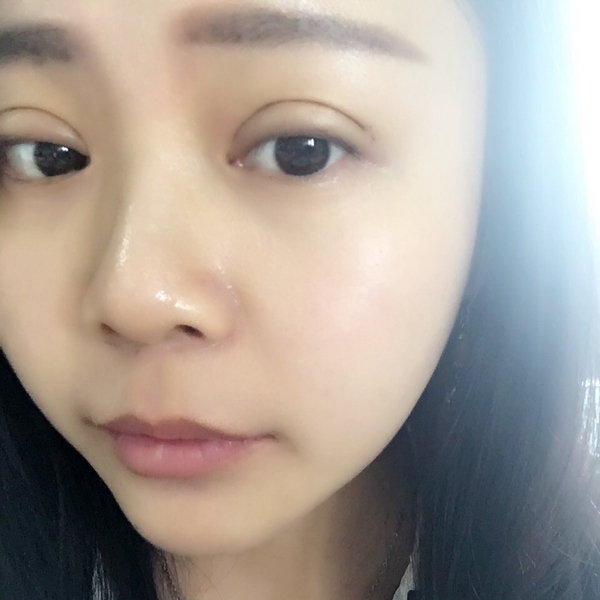 做完双眼皮眼睛像哭了一样,做完双眼皮哭了眼睛灰蒙蒙的