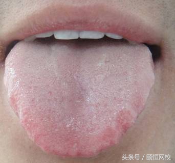 中医舌诊图谱100例,靠谱中医史上最全高清舌诊图谱