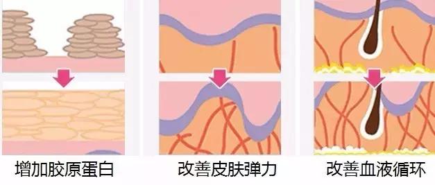 做线雕多久可以敷面膜,敷100次面膜不如打一次水光图片