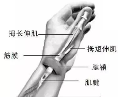 手机玩多了大拇指疼痛一招搞定,手机玩多了小拇指变形疼痛