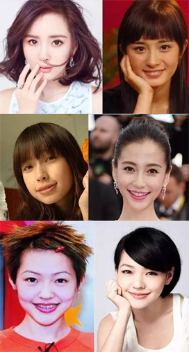 牙齿矫正隐形哪个品牌最好,牙齿矫正隐形牙套什么价格