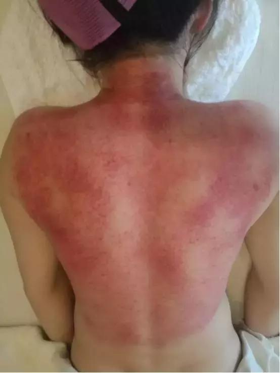 泌乳素39.39能不能治愈,泌乳素偏高中医怎么调