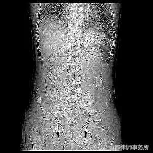 恒都法研｜*品毒**犯罪知多少？——运输*品毒**罪