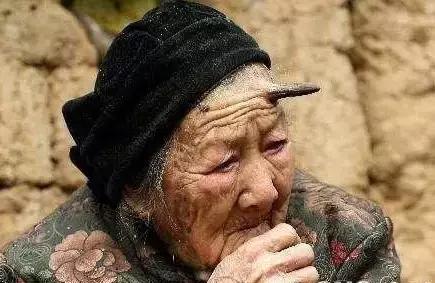 脸上长黄斑怎么检查,看脸上的斑如何知道什么病因